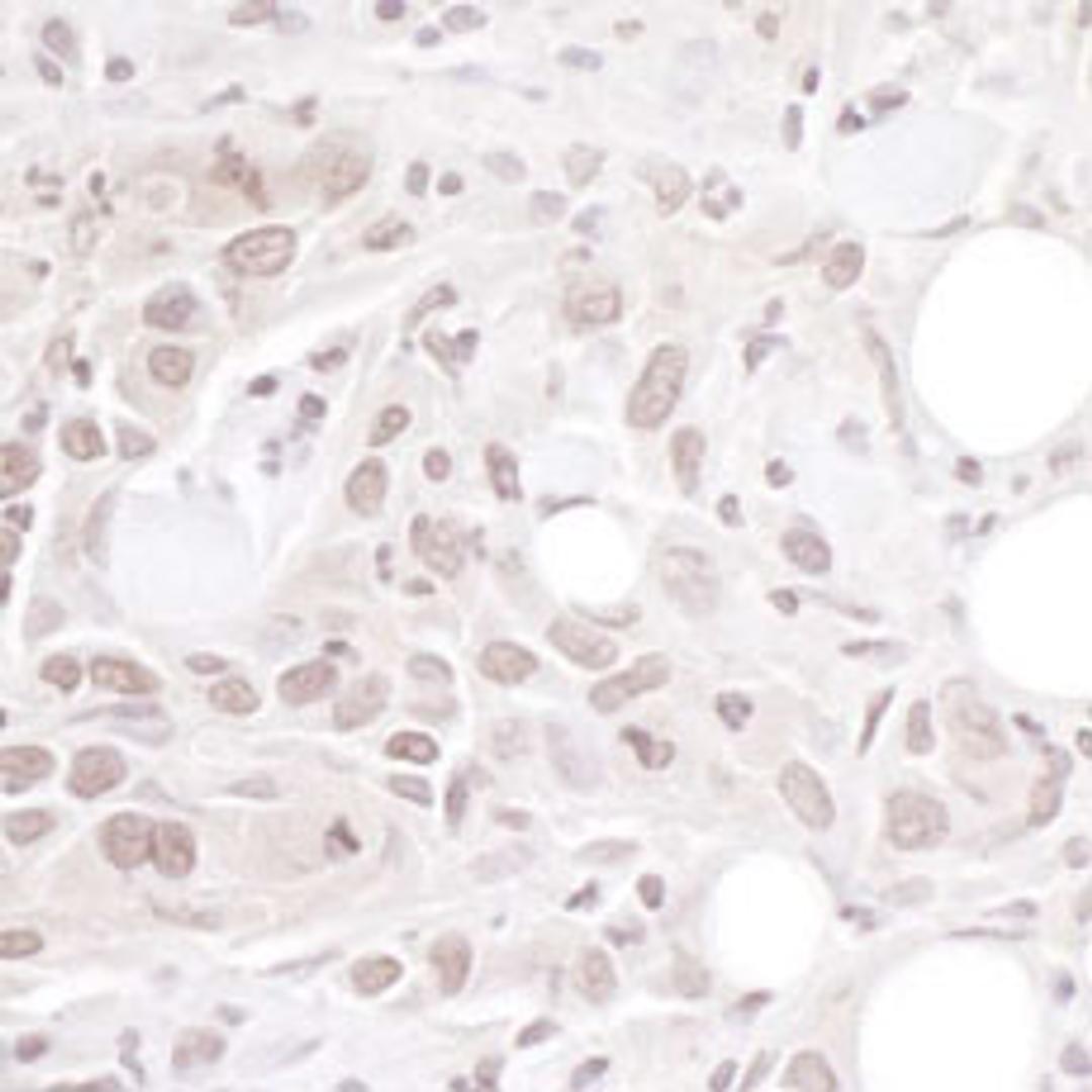 Detection of human Geminin by immunohistochemistry.