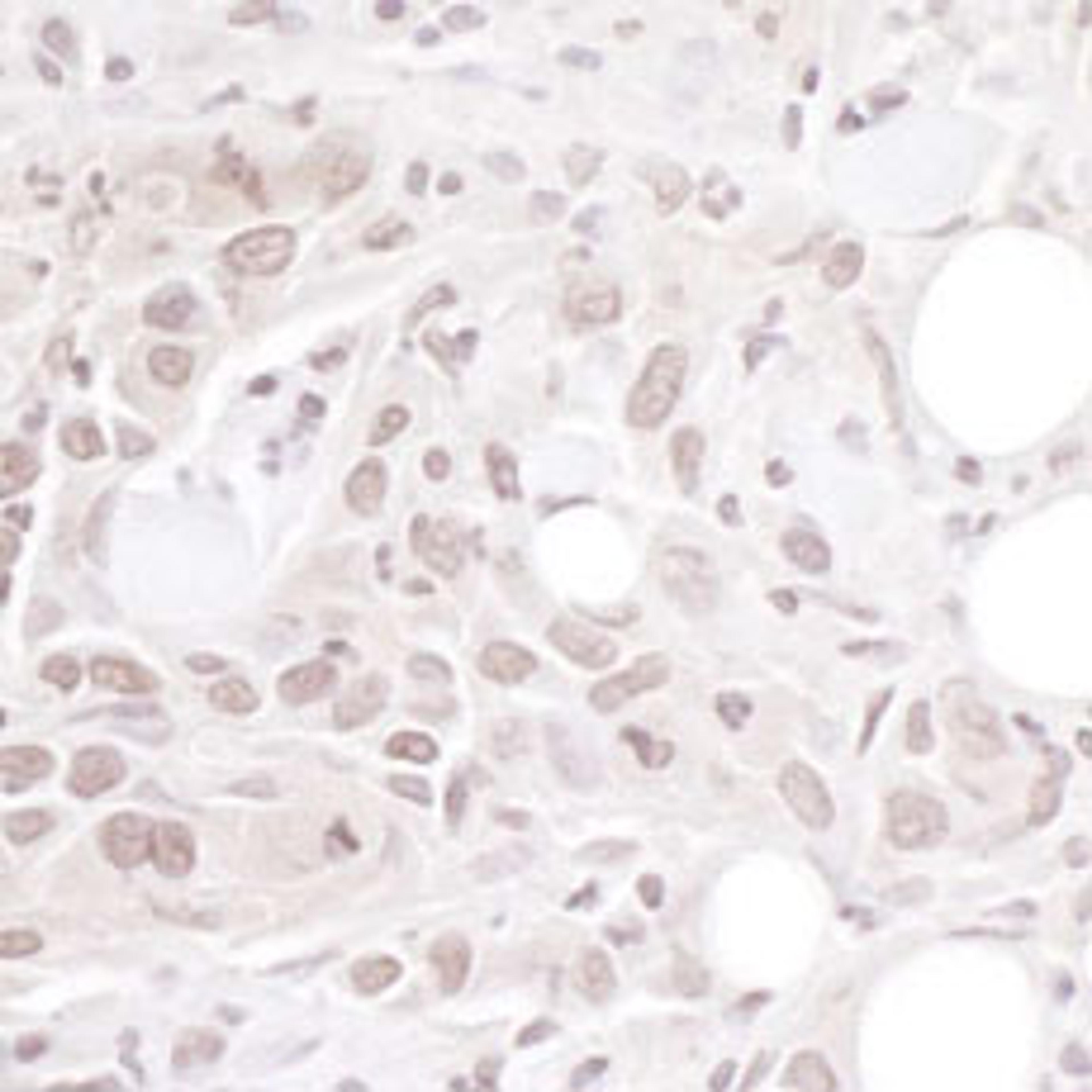 Detection of human Geminin by immunohistochemistry.