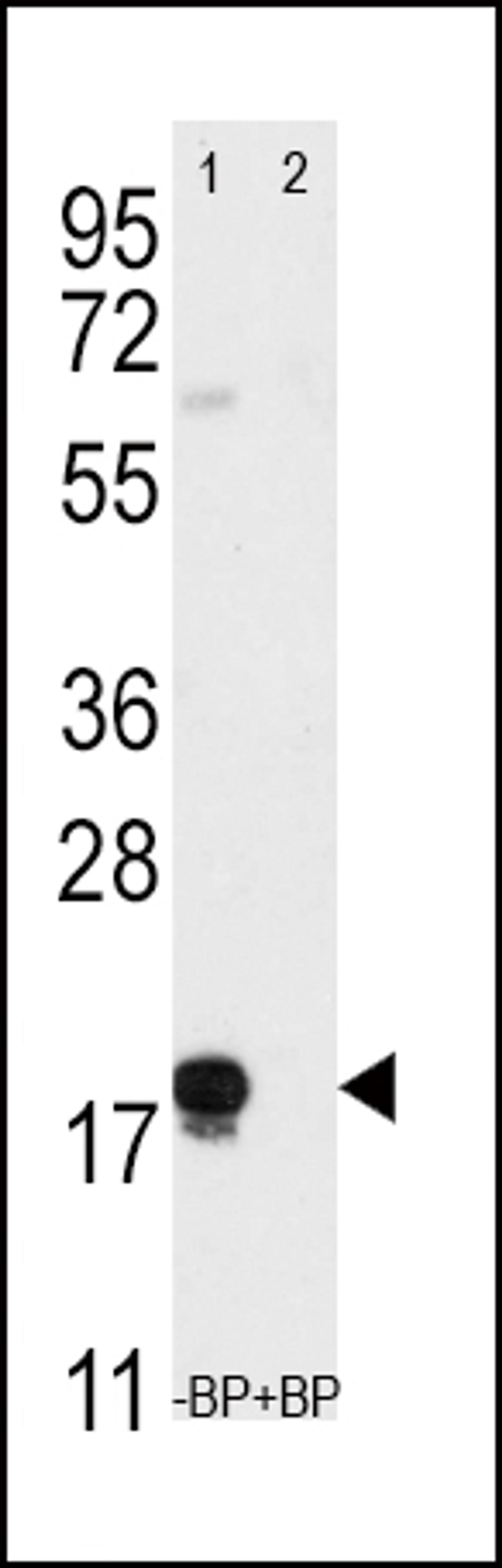 Western blot analysis of anti-THY1 Pab pre-incubated without(lane 1) and with(lane 2) blocking peptide (BP2050a) in T47D cell line lysate.