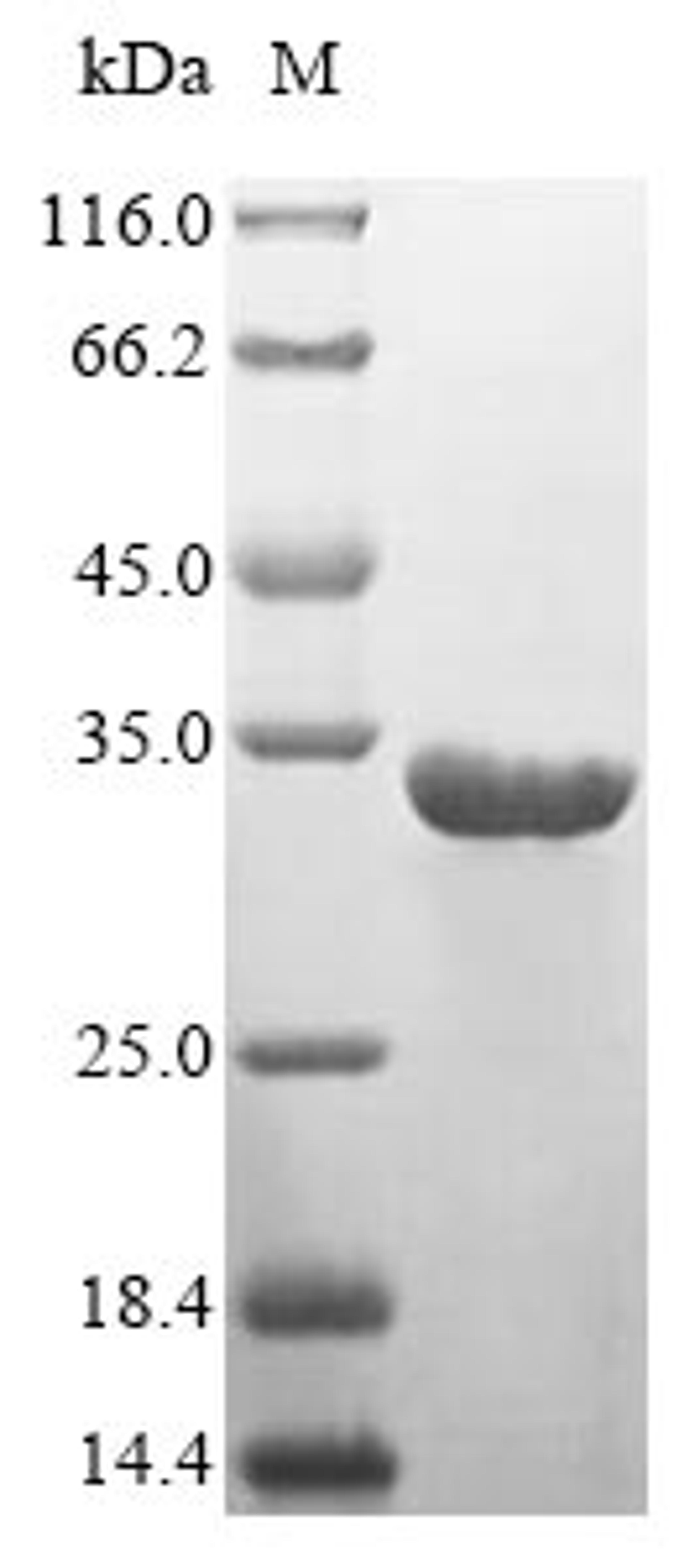 (Tris-Glycine gel) Discontinuous SDS-PAGE (reduced) with 5% enrichment gel and 15% separation gel.