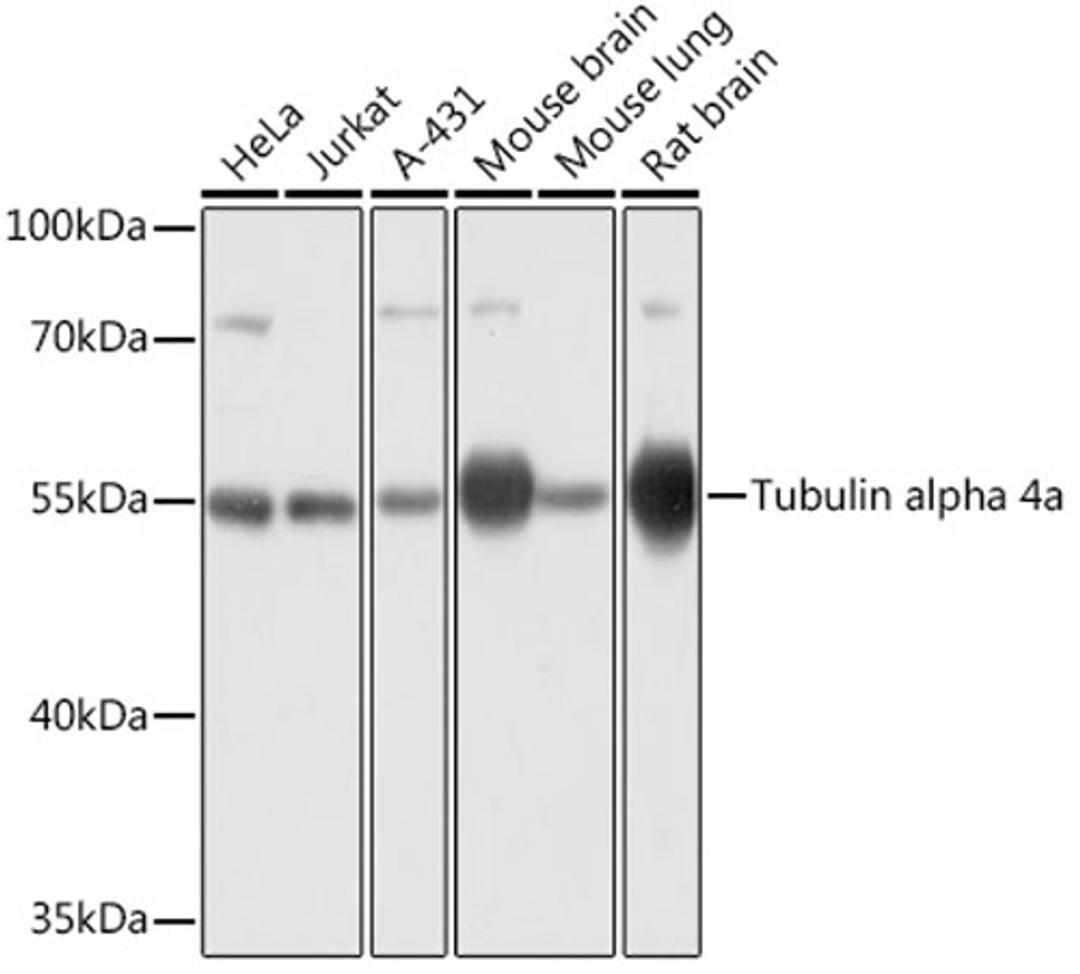 Western blot - Tubulin alpha 4a antibody (AC031)