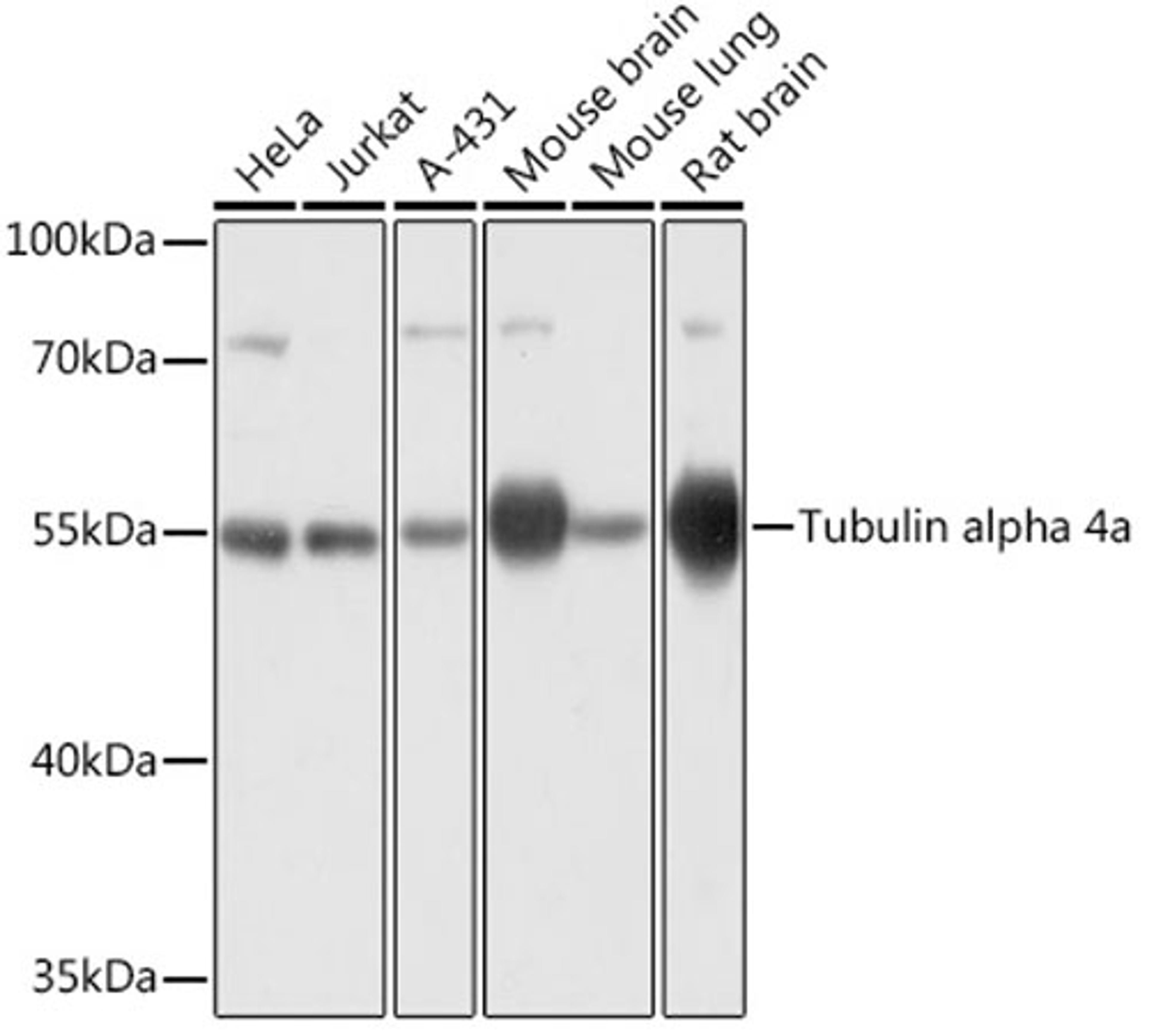 Western blot - Tubulin alpha 4a antibody (AC031)