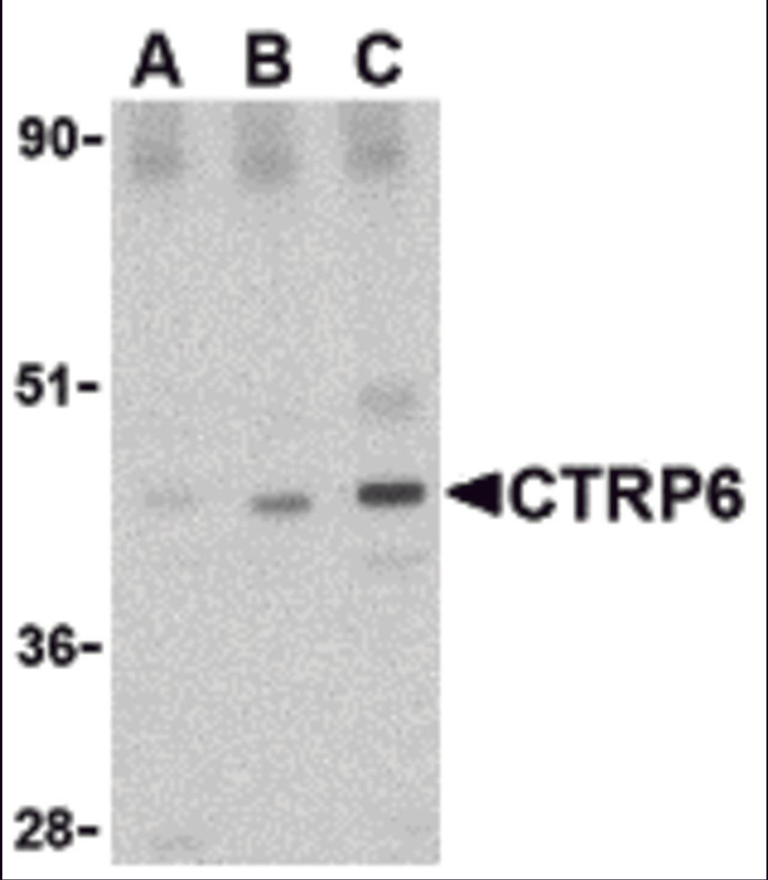 Western blot analysis of CTRP6 in mouse brain cell lysate with CTRP6 antibody at (A) 0.5, (B) 1 and (C) 2 &#956;g/mL.