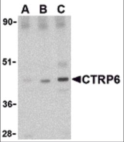 Western blot analysis of CTRP6 in mouse brain cell lysate with CTRP6 antibody at (A) 0.5, (B) 1 and (C) 2 &#956;g/mL.