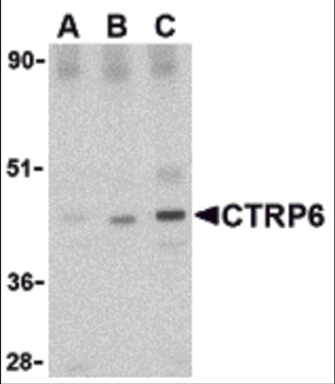 Western blot analysis of CTRP6 in mouse brain cell lysate with CTRP6 antibody at (A) 0.5, (B) 1 and (C) 2 μg/mL.