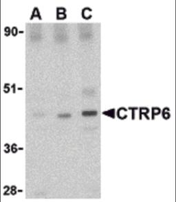 Western blot analysis of CTRP6 in mouse brain cell lysate with CTRP6 antibody at (A) 0.5, (B) 1 and (C) 2 μg/mL.