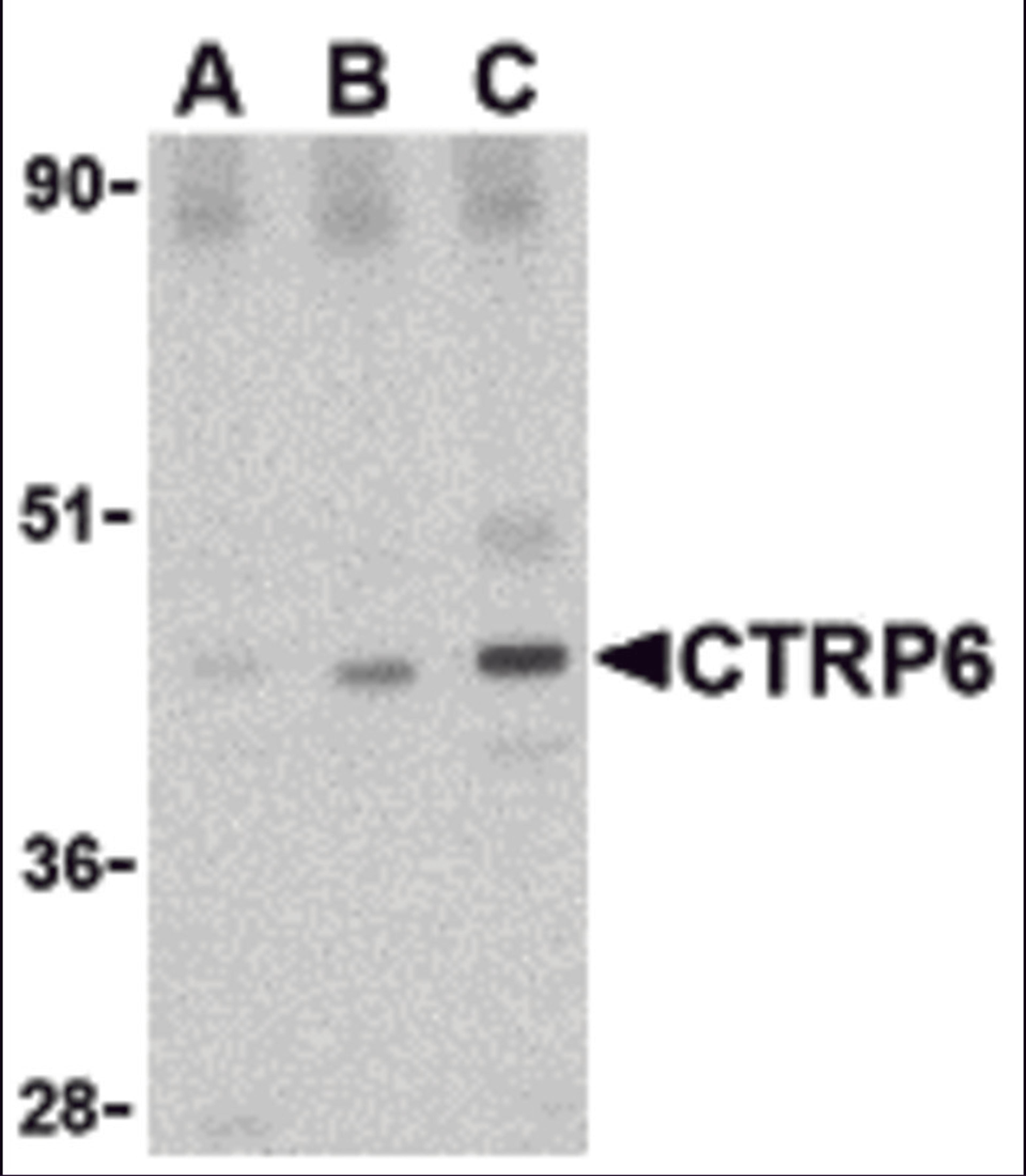 Western blot analysis of CTRP6 in mouse brain cell lysate with CTRP6 antibody at (A) 0.5, (B) 1 and (C) 2 μg/mL.