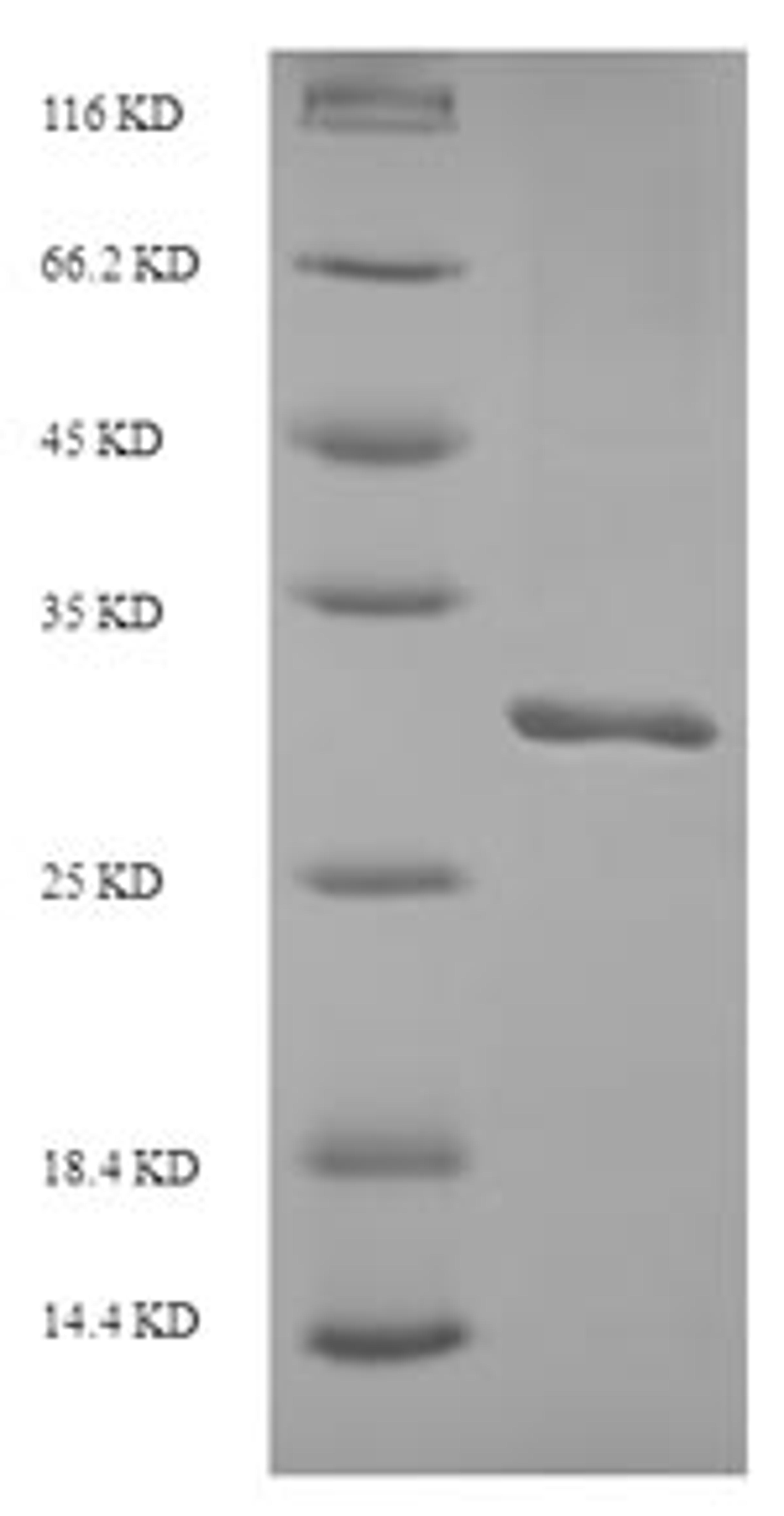 (Tris-Glycine gel) Discontinuous SDS-PAGE (reduced) with 5% enrichment gel and 15% separation gel.