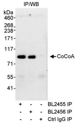 Detection of human CoCoA by western blot of immunoprecipitates.