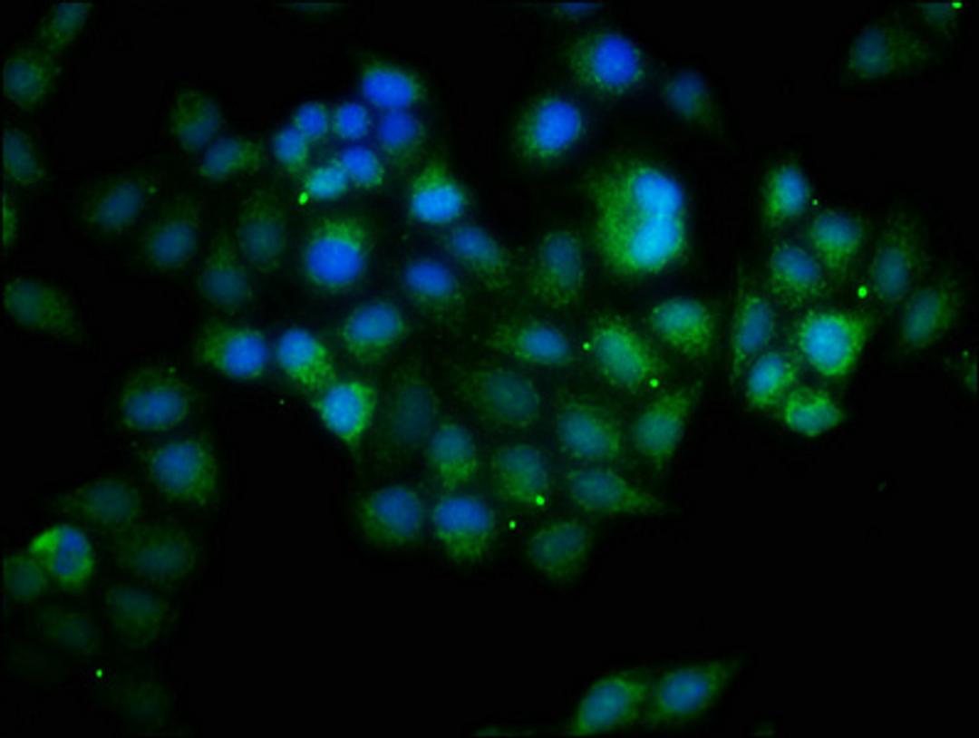 Immunofluorescence staining of Hela cells with CSB-PA002608HA01HU at 1:133, counter-stained with DAPI. The cells were fixed in 4% formaldehyde, permeabilized using 0.2% Triton X-100 and blocked in 10% normal Goat Serum. The cells were then incubated with the antibody overnight at 4&deg;C. The secondary antibody was Alexa Fluor 488-congugated AffiniPure Goat Anti-Rabbit IgG(H+L).