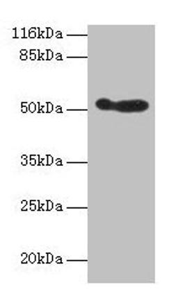 Western blot. All lanes: ALDH3A1 antibody at 2µg/ml + 293T whole cell lysate. Secondary. Goat polyclonal to rabbit IgG at 1/10000 dilution. Predicted band size: 51 kDa. Observed band size: 51 kDa