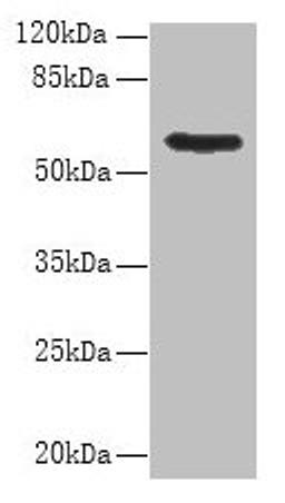 Western blot. All lanes: PDIA5 antibody at 8µg/ml + Hela whole cell lysate. Secondary. Goat polyclonal to rabbit IgG at 1/10000 dilution. Predicted band size: 60, 31 kDa. Observed band size: 60 kDa