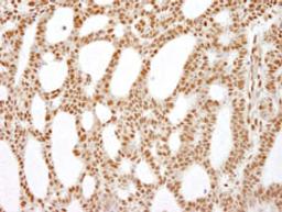 Detection of human RecQ1 by immunohistochemistry.