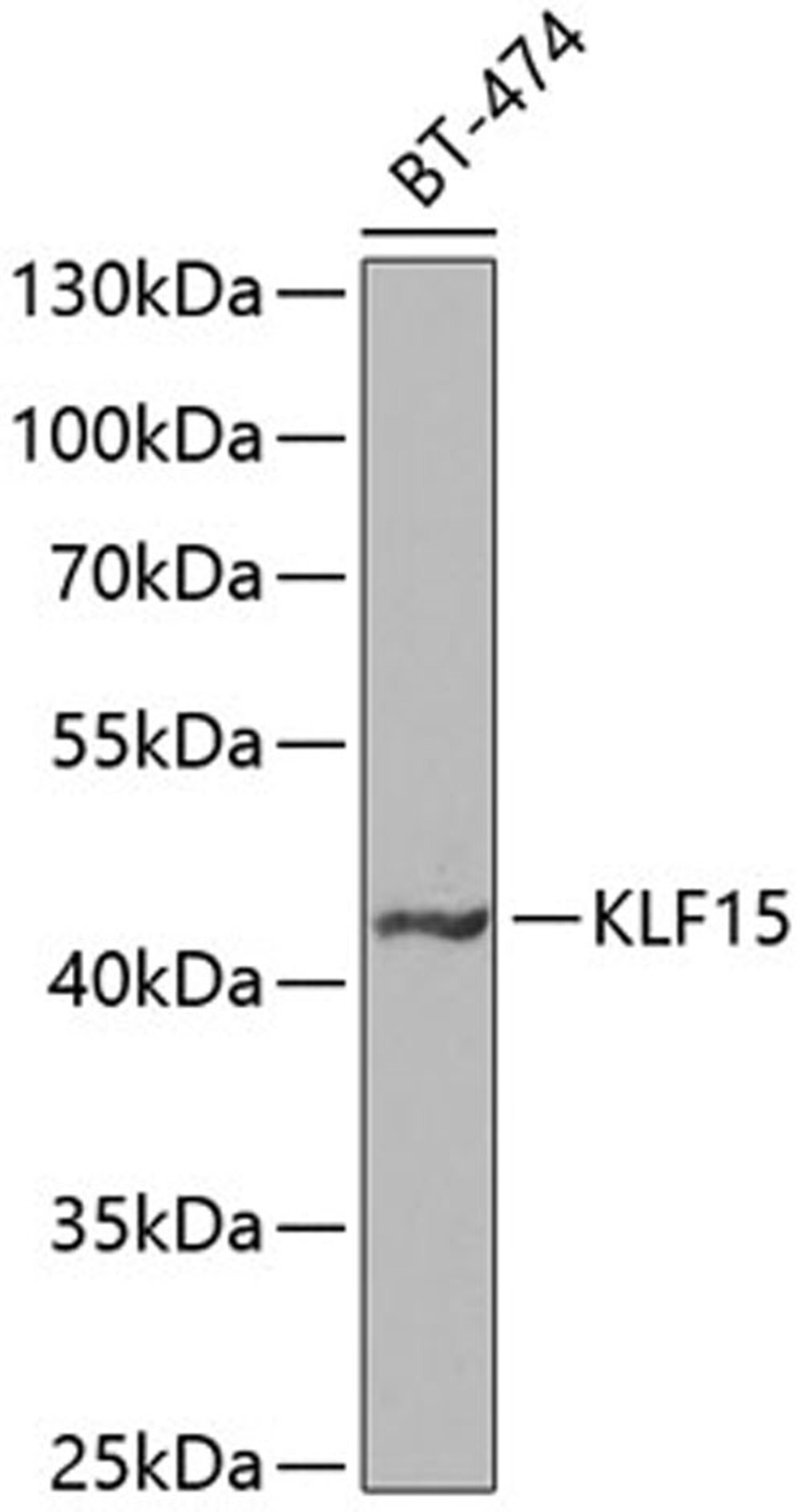 Western blot - KLF15 antibody (A7194)