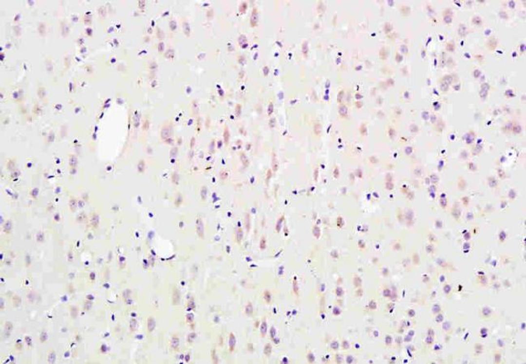 IHC-P of rat brain tissue using SCN3B antibody.