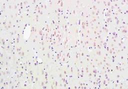 IHC-P of rat brain tissue using SCN3B antibody.