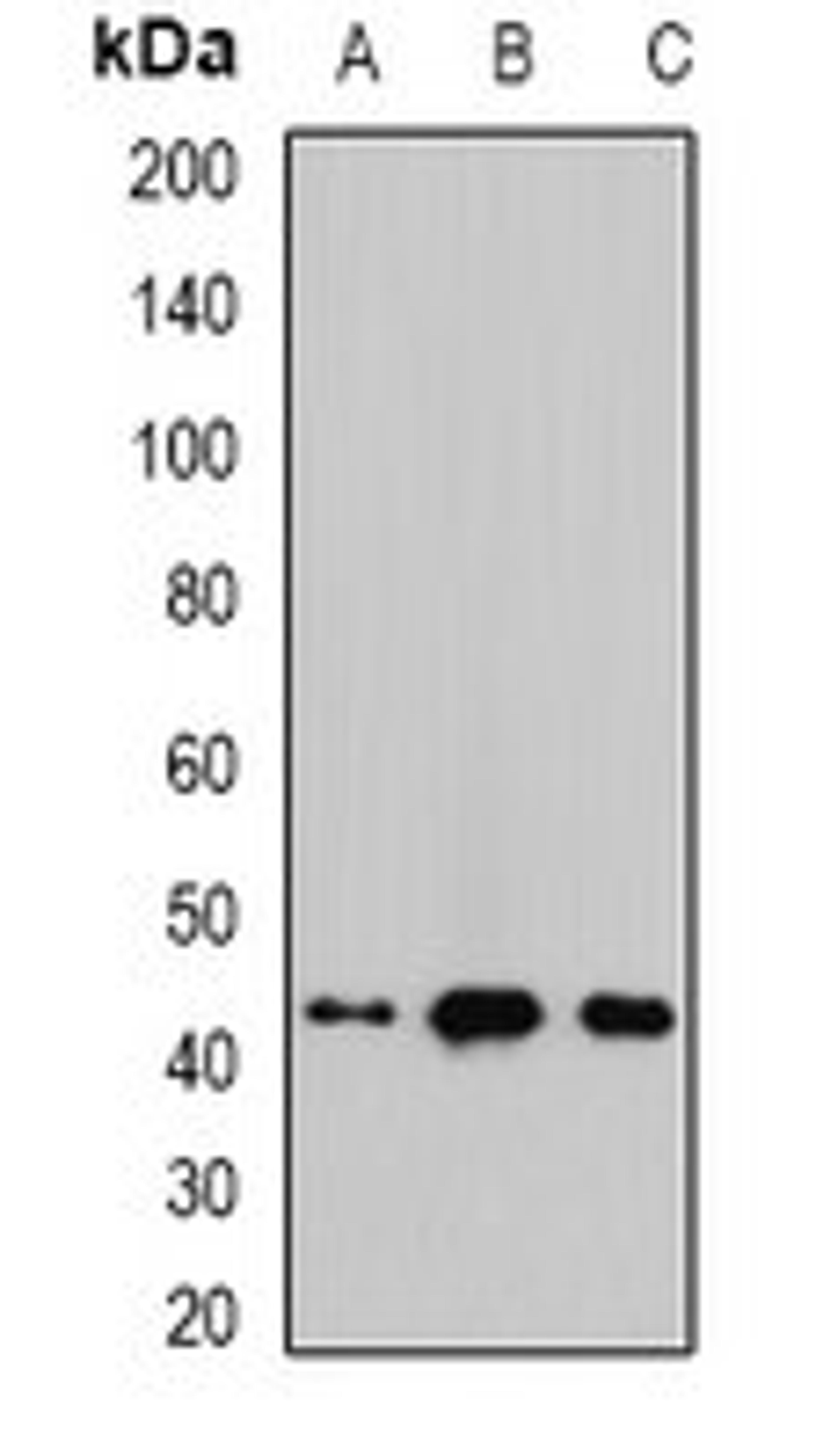 Western blot analysis of mouse brain (Lane1), mouse heart (Lane2), rat liver (Lane3) whole cell lysates using NHLRC1 antibody