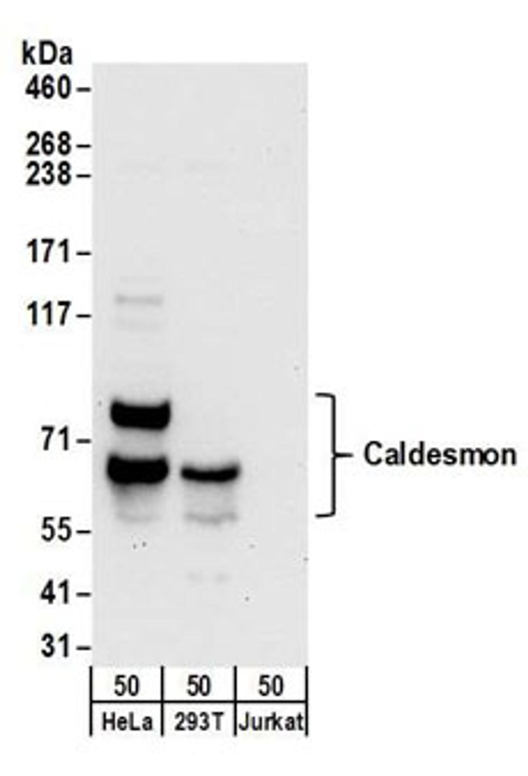 Detection of human Caldesmon by western blot.