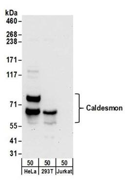 Detection of human Caldesmon by western blot.