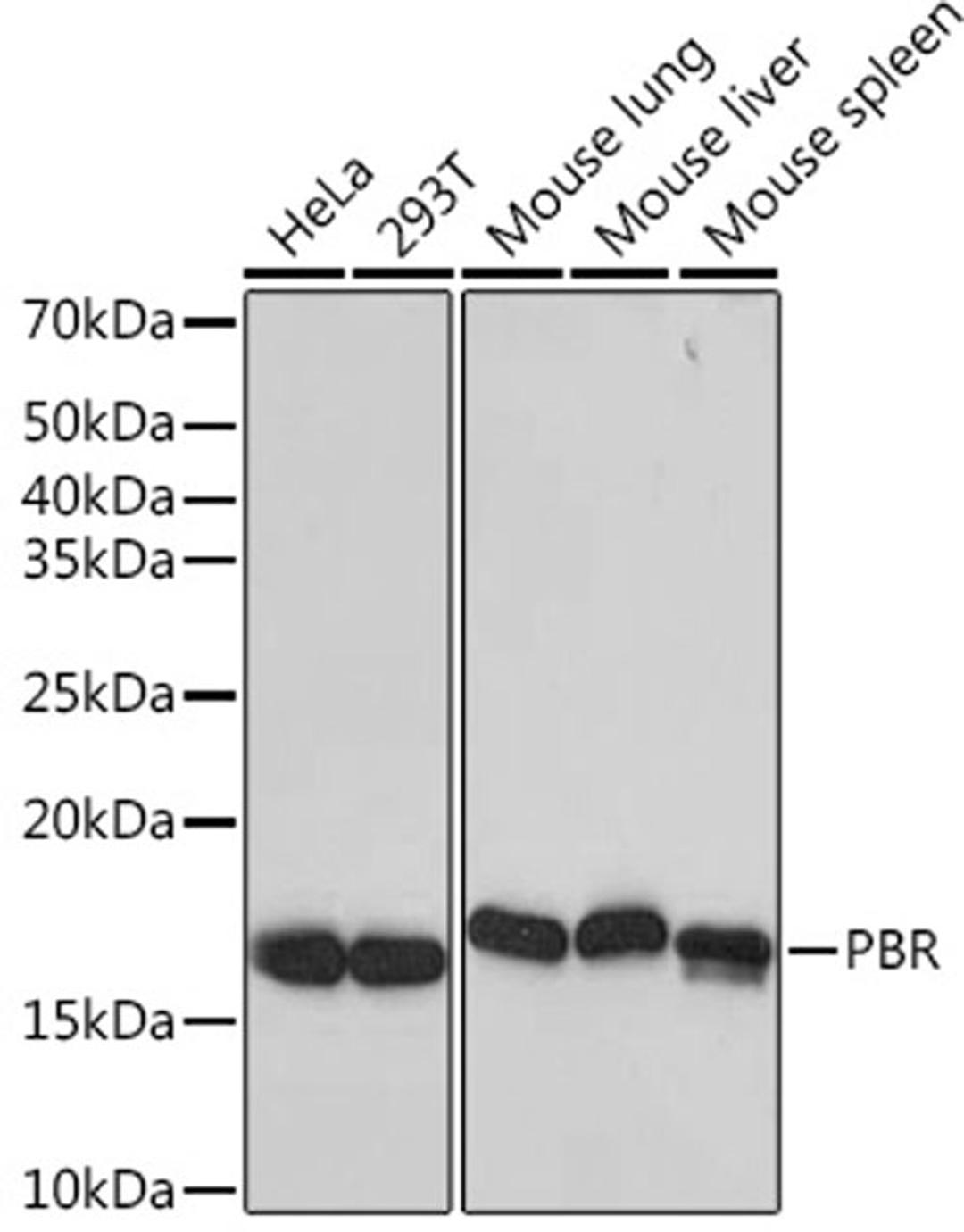 Western blot - PBR   Rabbit mAb (A4881)