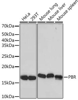 Western blot - PBR   Rabbit mAb (A4881)