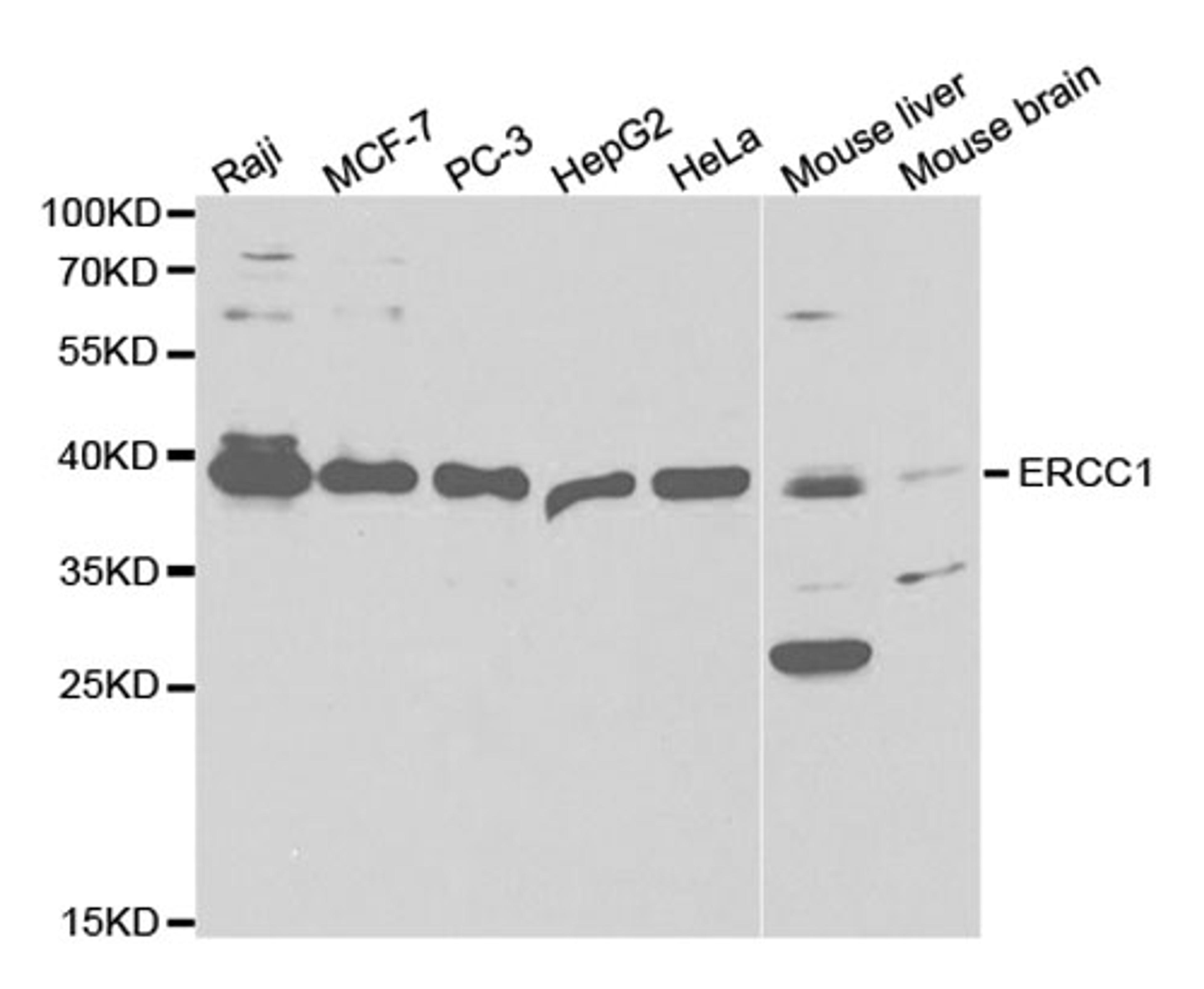 Western blot - ERCC1 antibody (A5291)