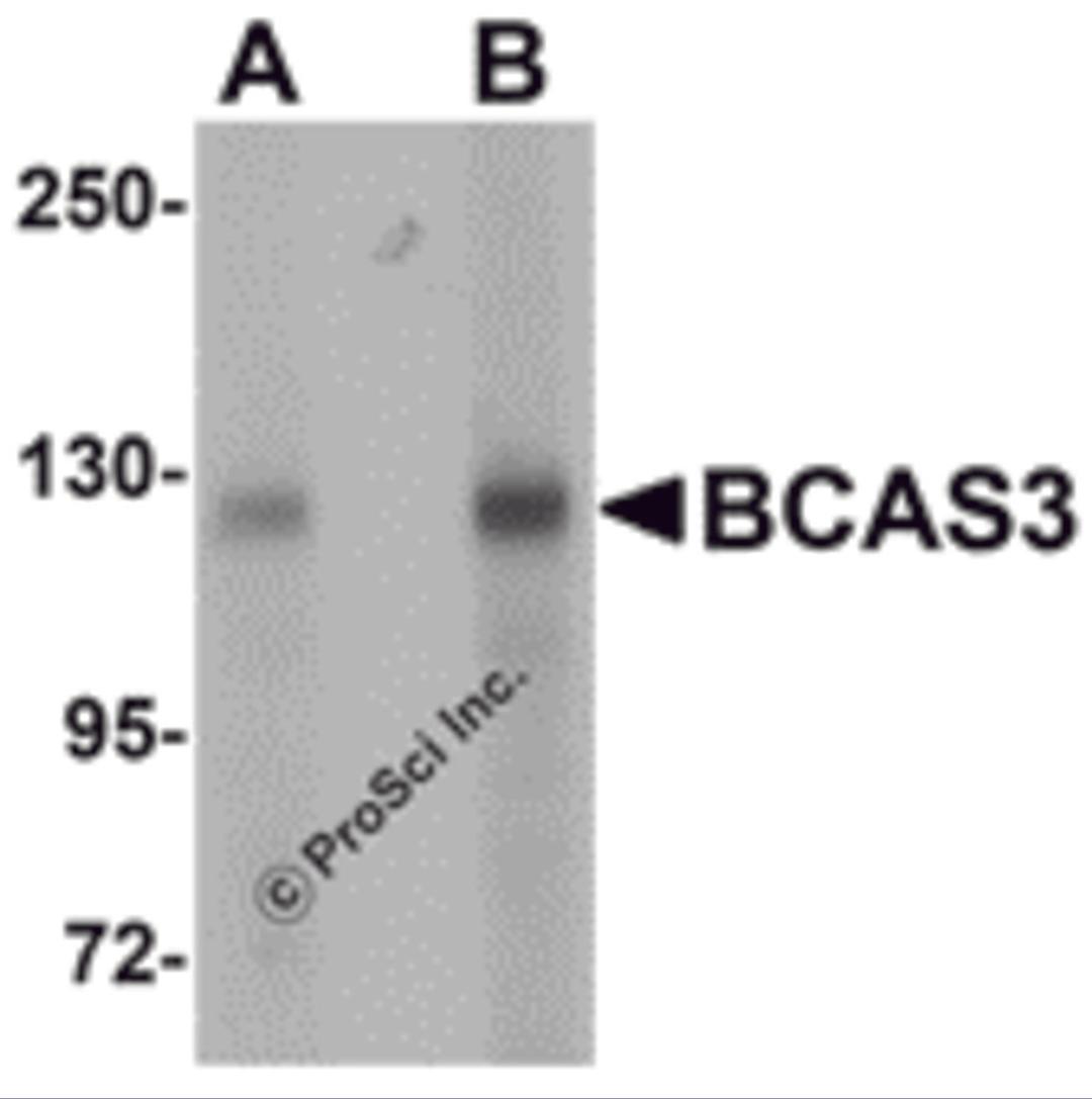 Western blot analysis of BCAS3 in rat brain tissue lysate with BCAS3 antibody at (A) 0.5 and (B) 1 μg/mL.