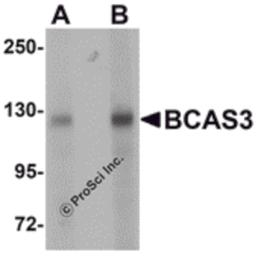 Western blot analysis of BCAS3 in rat brain tissue lysate with BCAS3 antibody at (A) 0.5 and (B) 1 μg/mL.