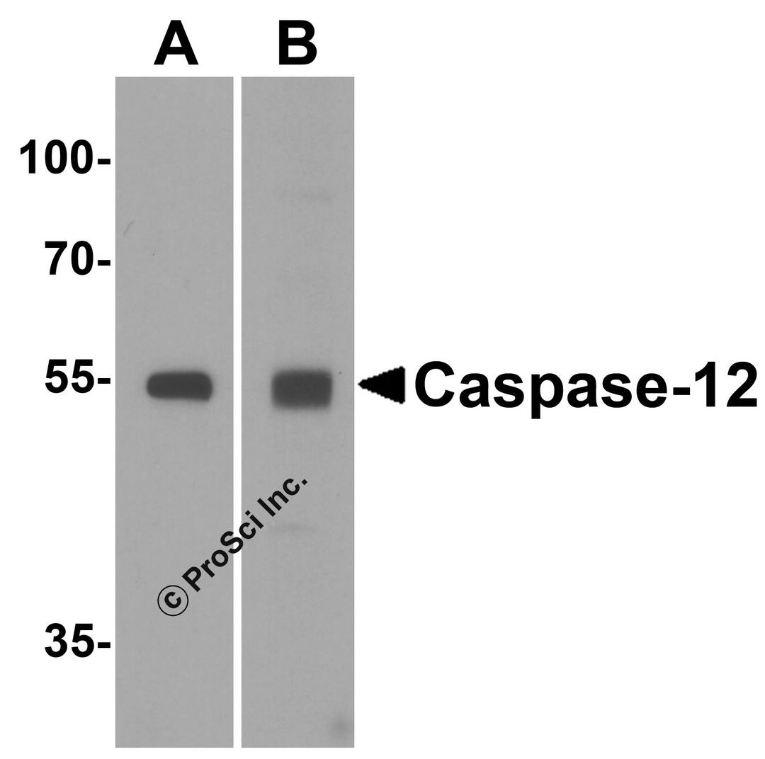 Western blot analysis of Caspase-12 in (A) human spleen and (B) mouse spleen tissue lysate with Caspase-12 antibody at 1 μg/mL.