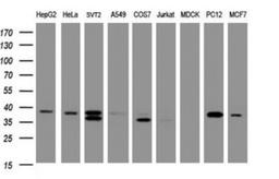 Western Blot: DCPS Antibody (4H8) [NBP2-45650] - Analysis of extracts (35ug) from 9 different cell lines by using DCPS monoclonal antibody (HepG2: human; HeLa: human; SVT2: mouse; A549: human; COS7: monkey; Jurkat: human; MDCK: canine; PC12: rat; MCF7: human).