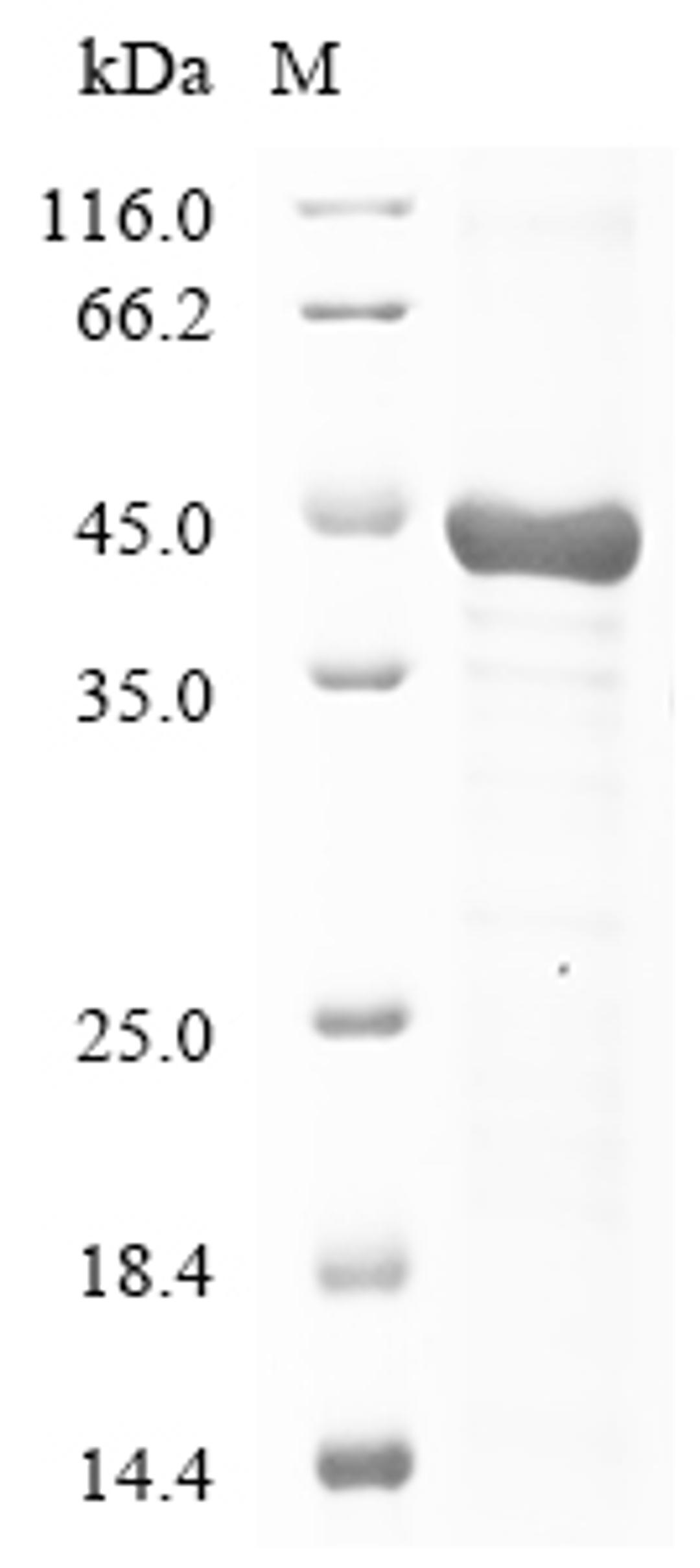 (Tris-Glycine gel) Discontinuous SDS-PAGE (reduced) with 5% enrichment gel and 15% separation gel.
