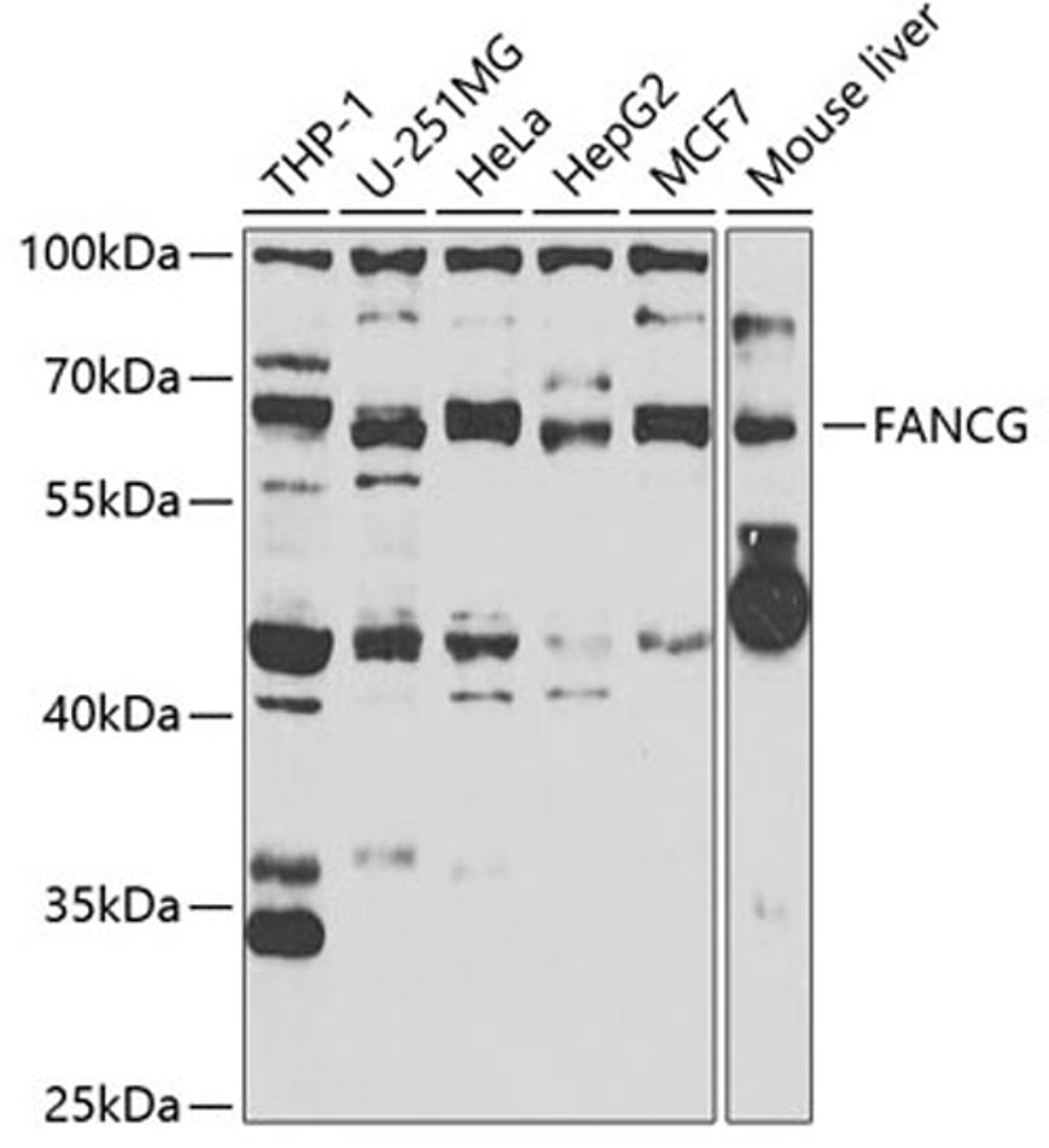 Western blot - FANCG antibody (A6206)