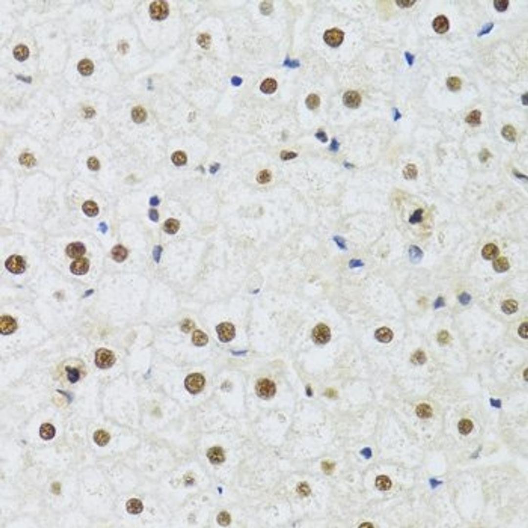 Immunohistochemistry of paraffin-embedded human liver using DDB1 antibody