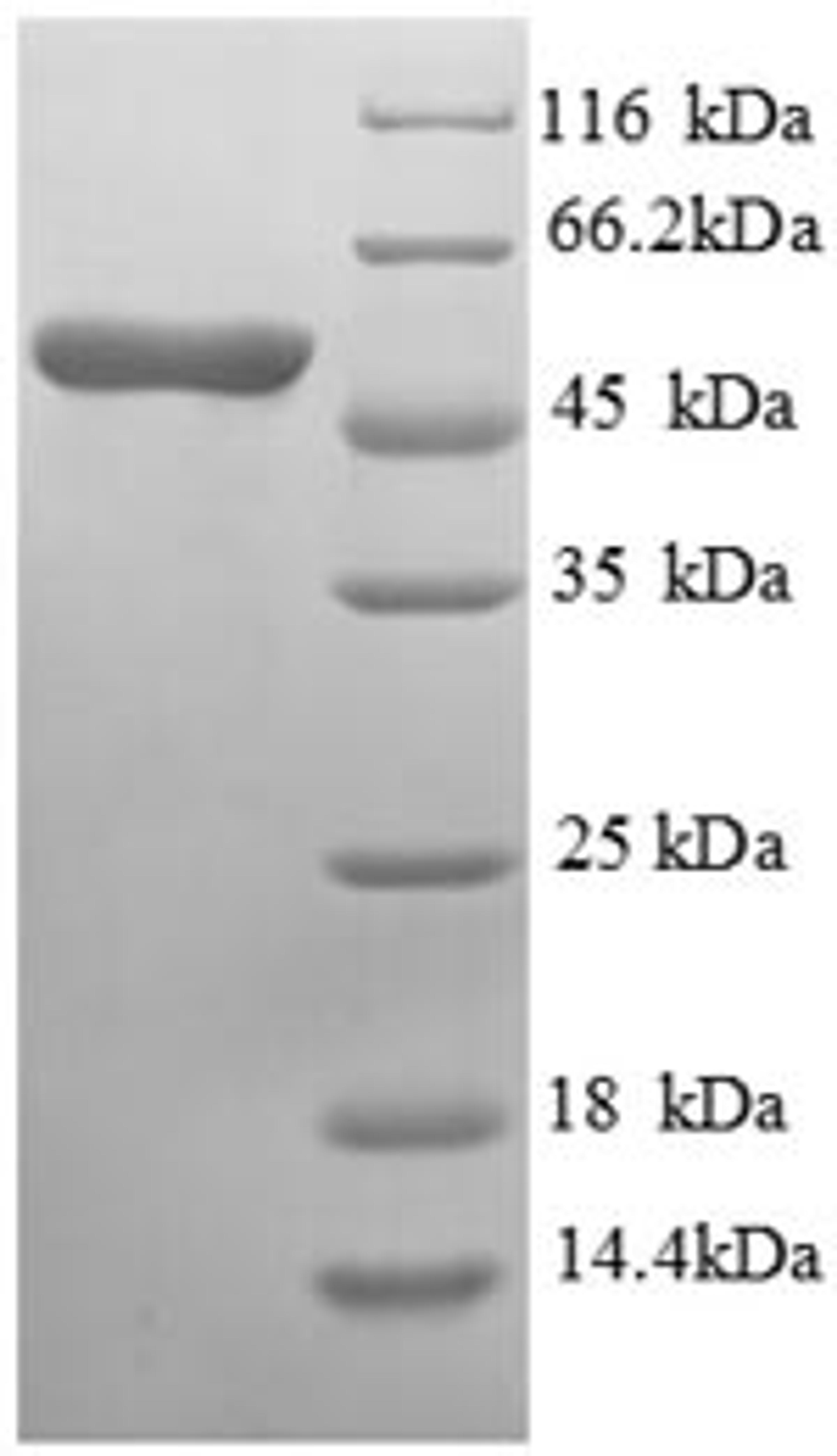 (Tris-Glycine gel) Discontinuous SDS-PAGE (reduced) with 5% enrichment gel and 15% separation gel.