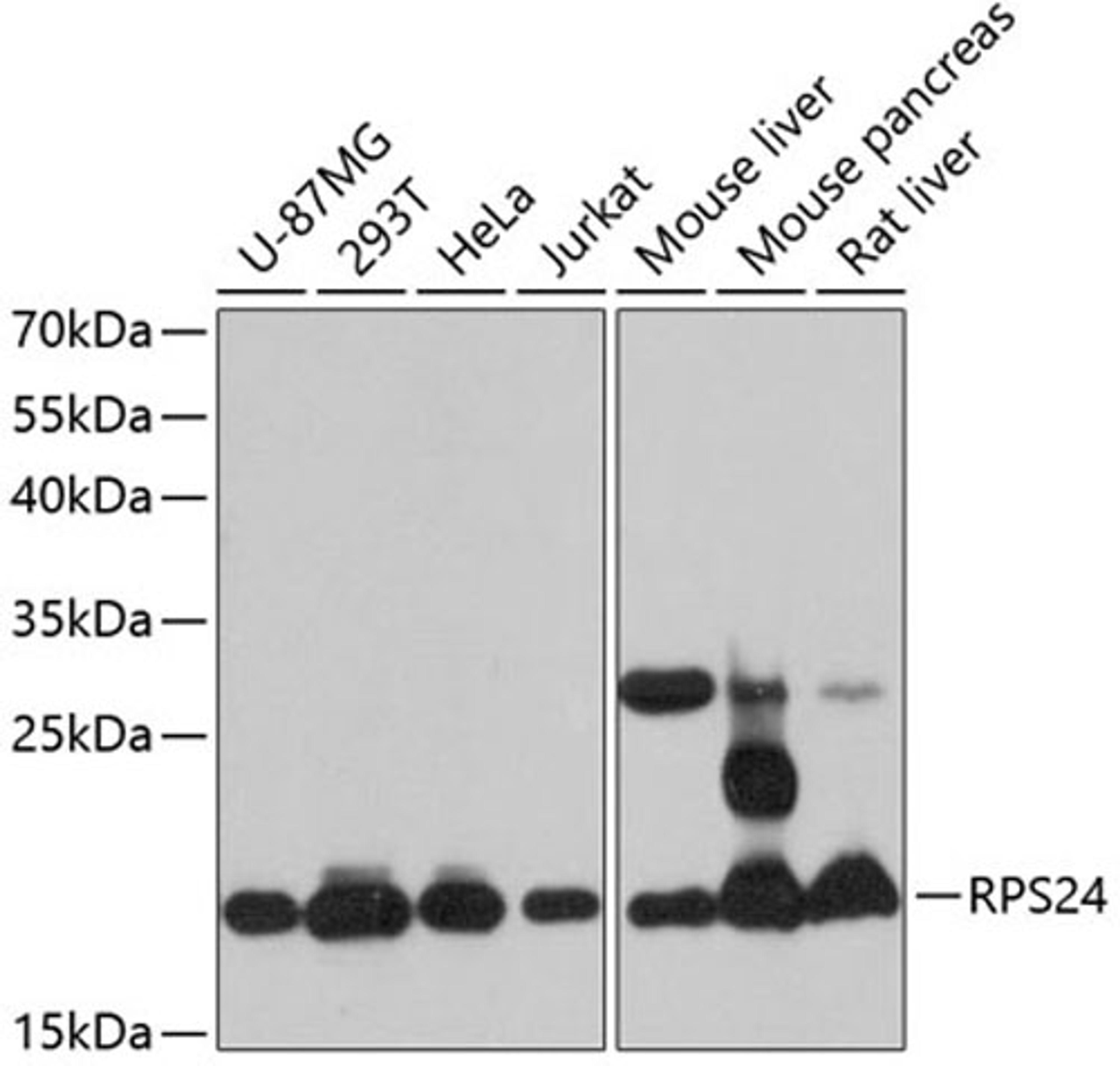 Western blot - RPS24 antibody (A12123)