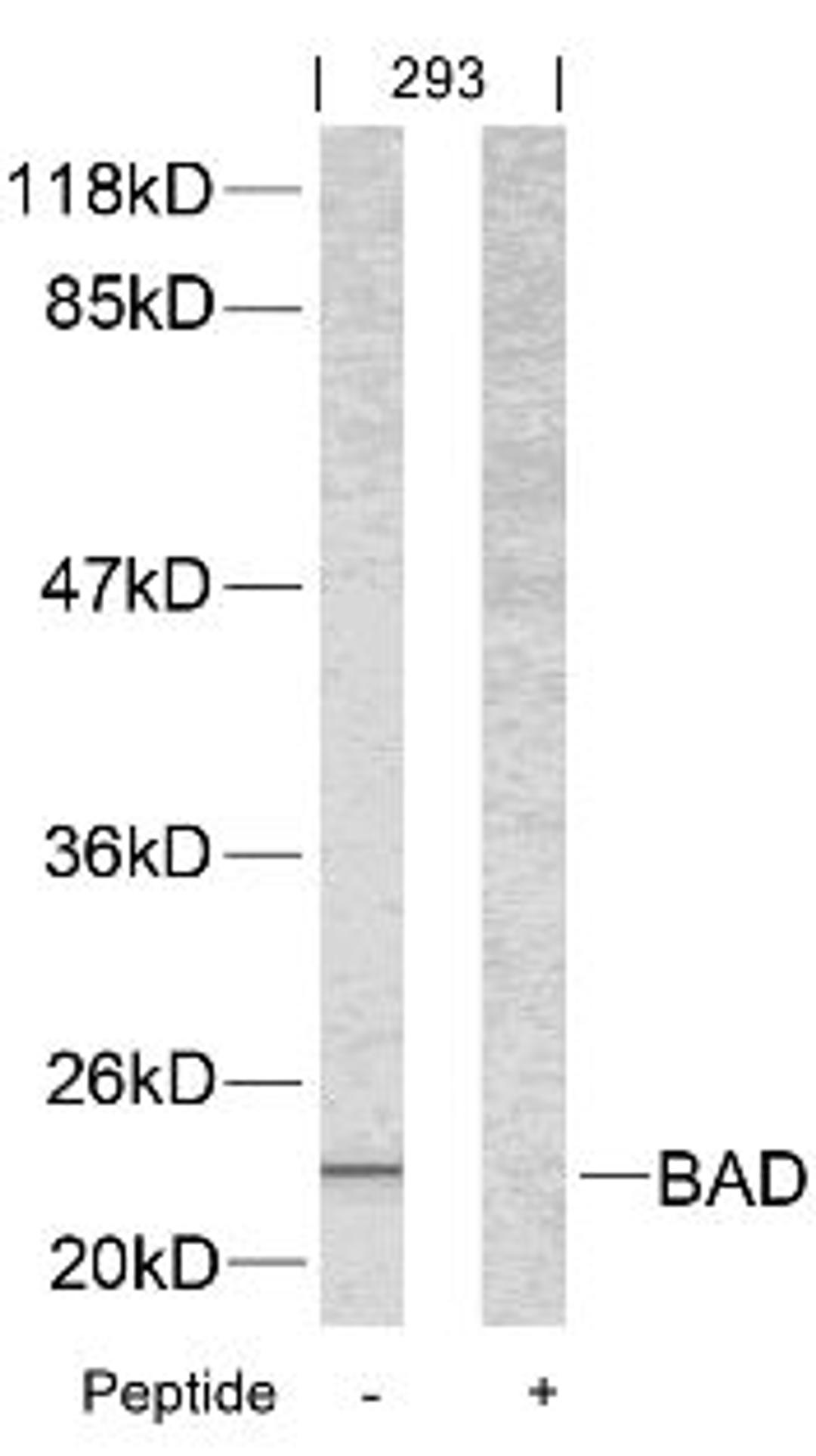 Western blot analysis of lysed extracts from 293 cells using BAD (Ab-112).