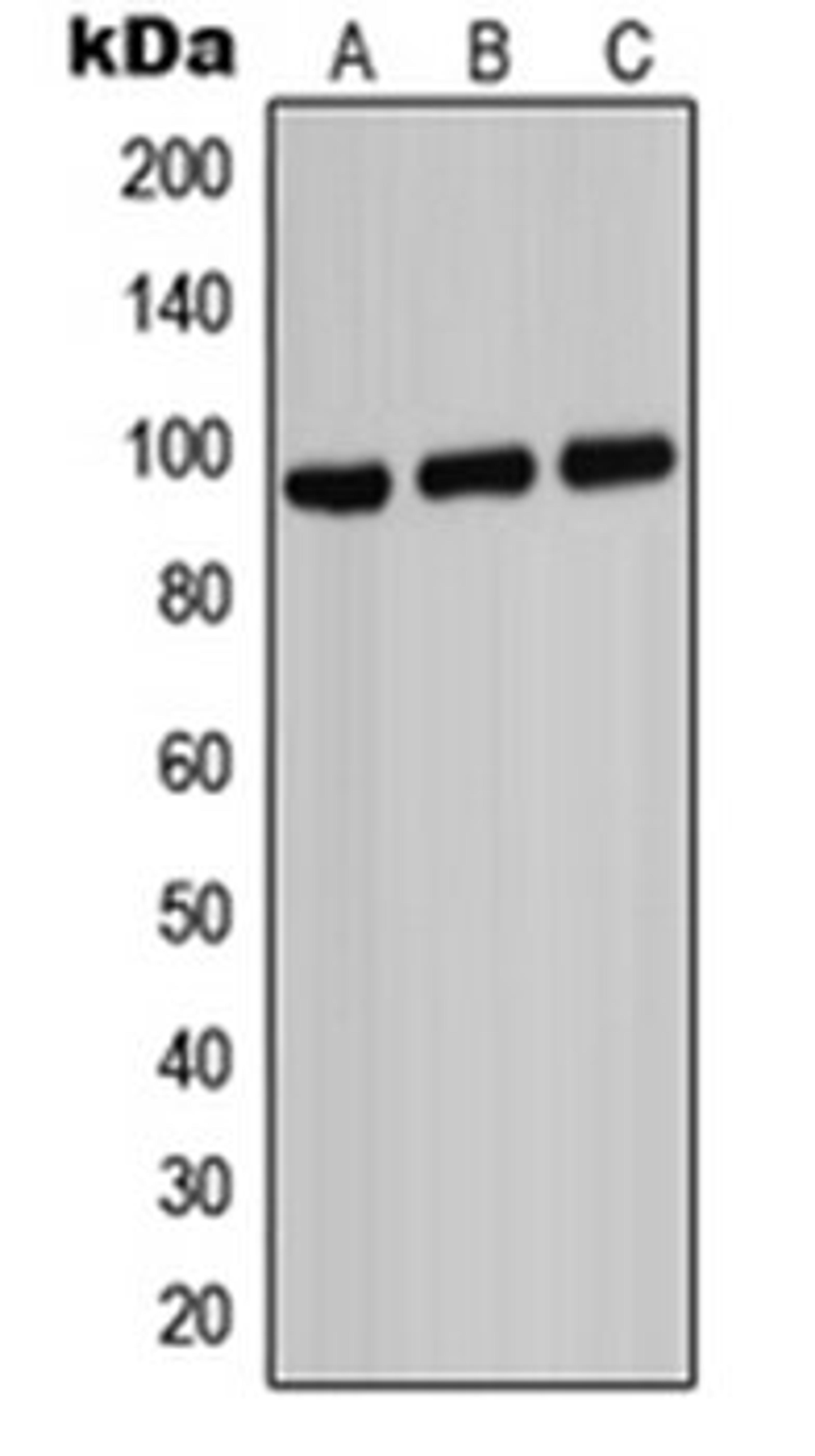 Western blot analysis of HeLa (Lane 1), Raw264.7 (Lane 2), PC12 (Lane 3) whole cell lysates using ABCB7 antibody