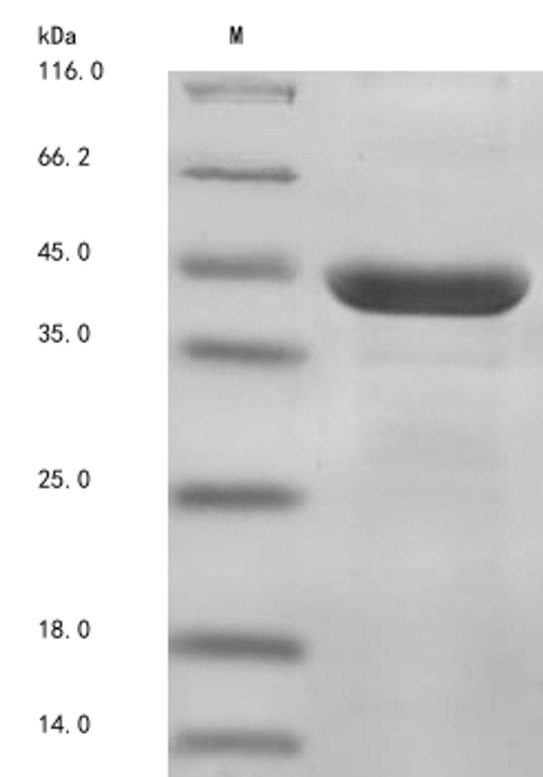 (Tris-Glycine gel) Discontinuous SDS-PAGE (reduced) with 5% enrichment gel and 15% separation gel.
