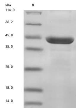 (Tris-Glycine gel) Discontinuous SDS-PAGE (reduced) with 5% enrichment gel and 15% separation gel.