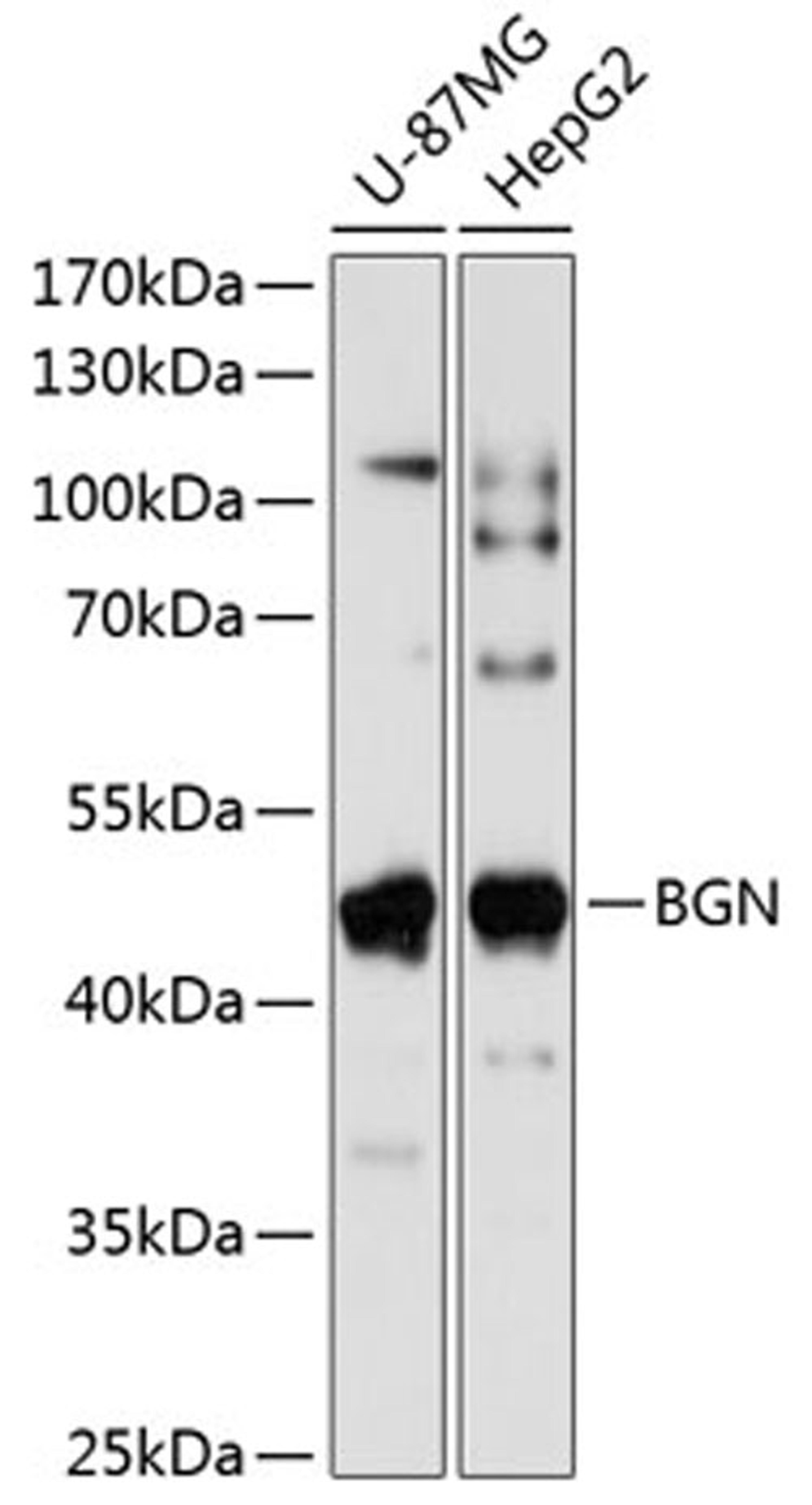 Western blot - BGN antibody (A3137)