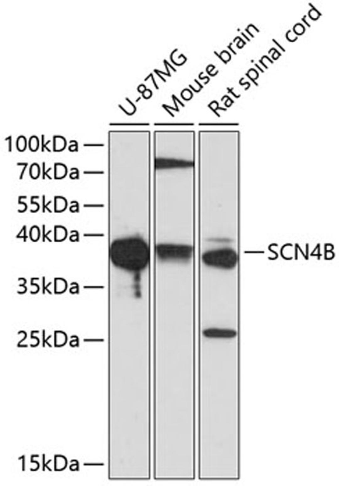 Western blot - SCN4B antibody (A2154)