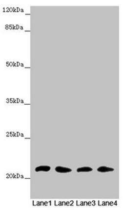 Western blot. All lanes: MSRB3 antibody at 4.61 ug/ml. Lane 1: Mouse large intestine tissue. Lane 2: Mouse lung tissue. Lane 3: Mouse gonadal tissue. Lane 4: Mouse heart tissue. Secondary. Goat polyclonal to rabbit IgG at 1/10000 dilution. Predicted band size: 21 kDa. Observed band size: 21 kDa.