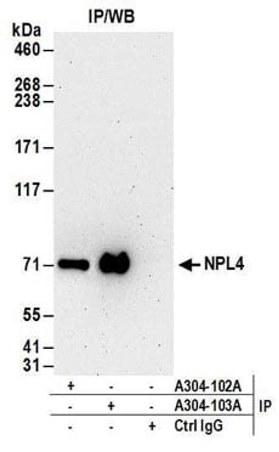 Detection of human NPL4 by western blot of immunoprecipitates.