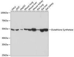 Western blot - Glutathione Synthetase Rabbit mAb (A11557)