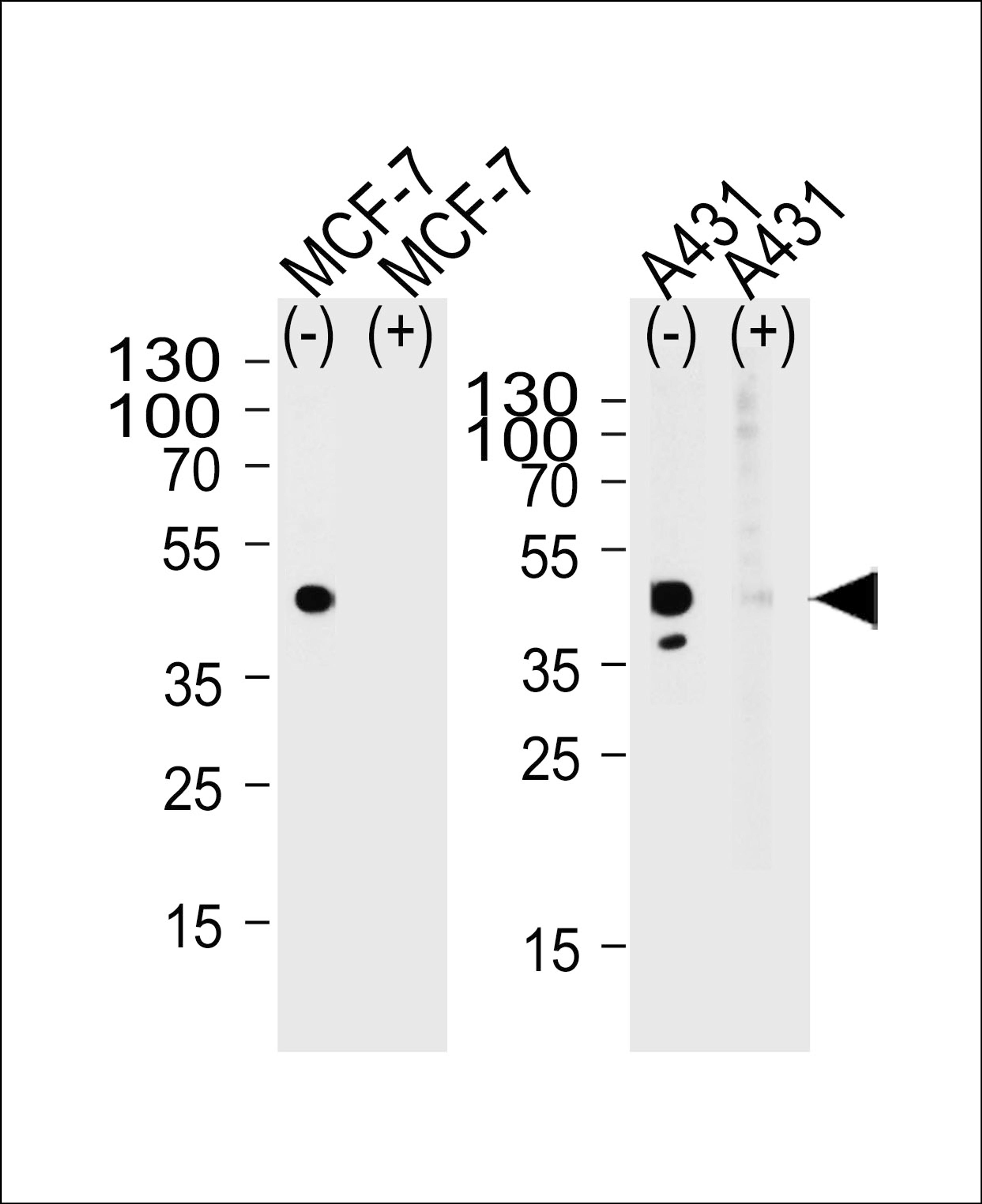 Western blot analysis of lysate from MCF-7, A431 cell line, using CALCR Antibody with(+) or without(-) peptides at 1:1000 at each lane. A goat anti-rabbit(HRP) at 1:5000 dilution was used as the secondary antibody. Lysate at 35ug per lane.