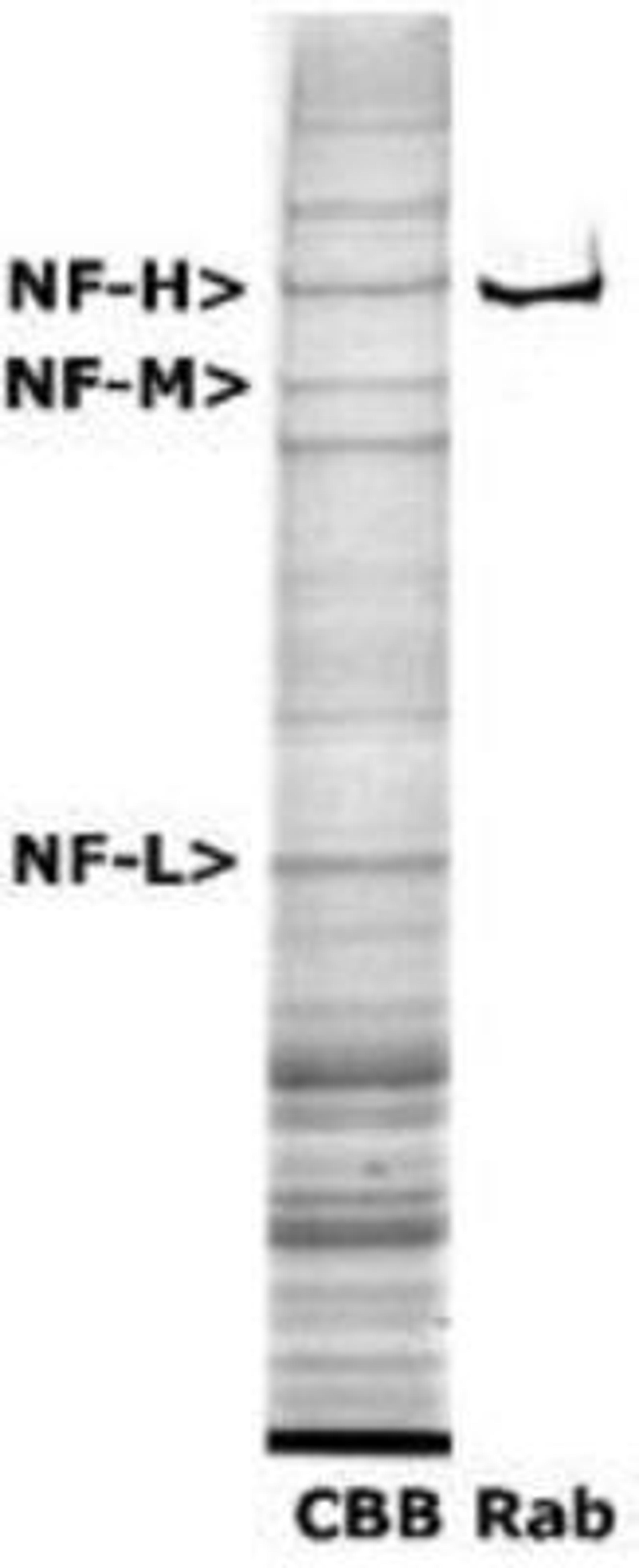 Western Blot: 200kDa Neurofilament Heavy Antibody [NB300-135] - Western blot analysis of 200kDa Neurofilament Heavy expression in rat spinal cord extract.  The first lane is Coomassie Brilliant Blue stained and the second lane is probed with rabbit anti-Neurofilament Heavy antibody NB300-135.  The NF-H corresponds to a weight of 200kDa.