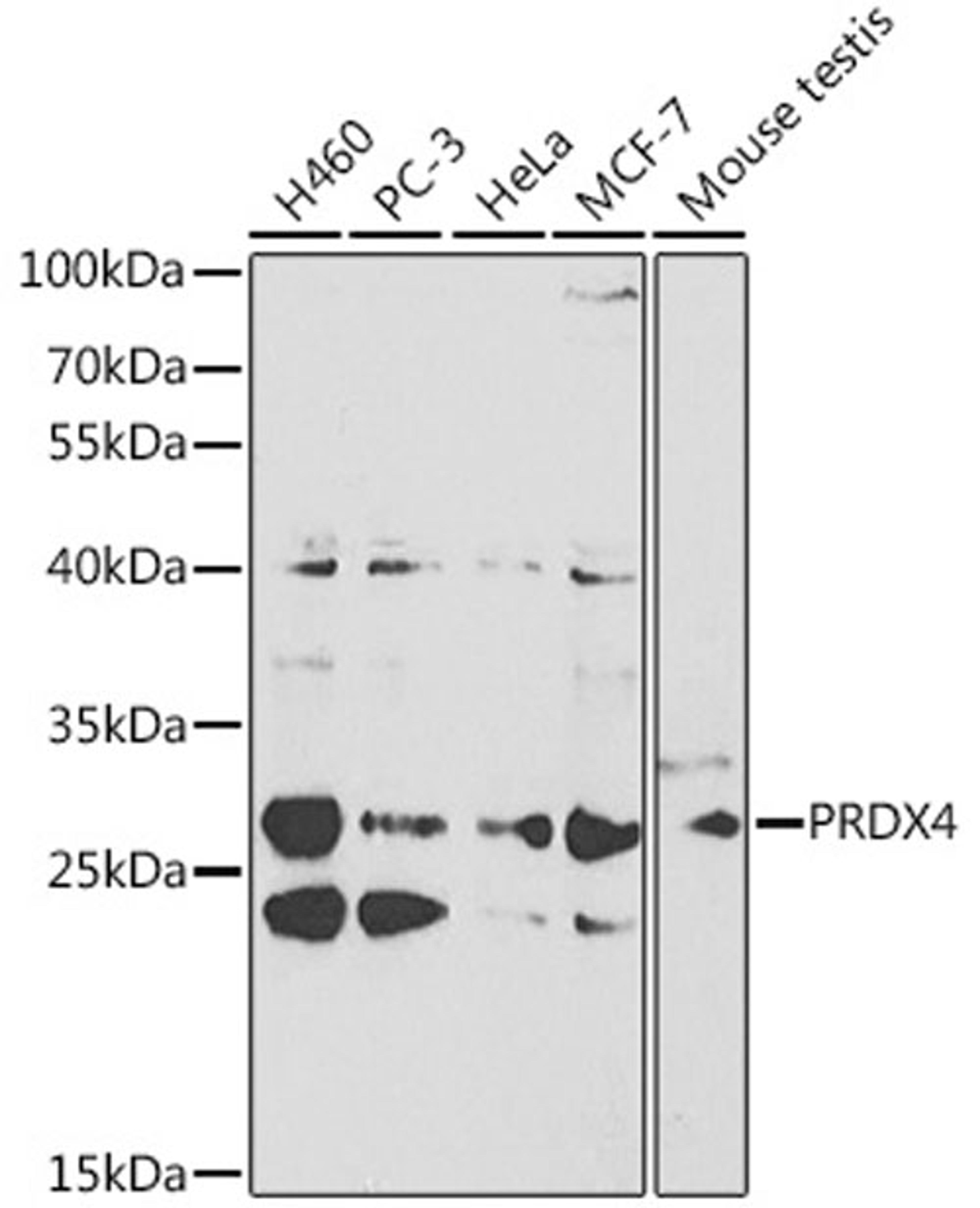 Western blot - PRDX4 antibody (A1486)