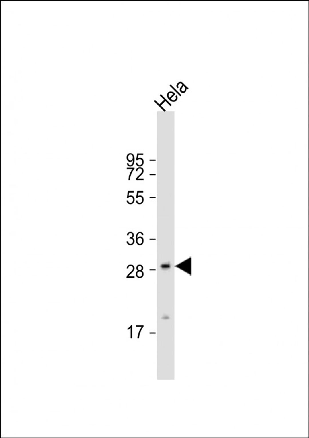 Western Blot at 1:8000 dilution + Hela whole cell lysate Lysates/proteins at 20 ug per lane.