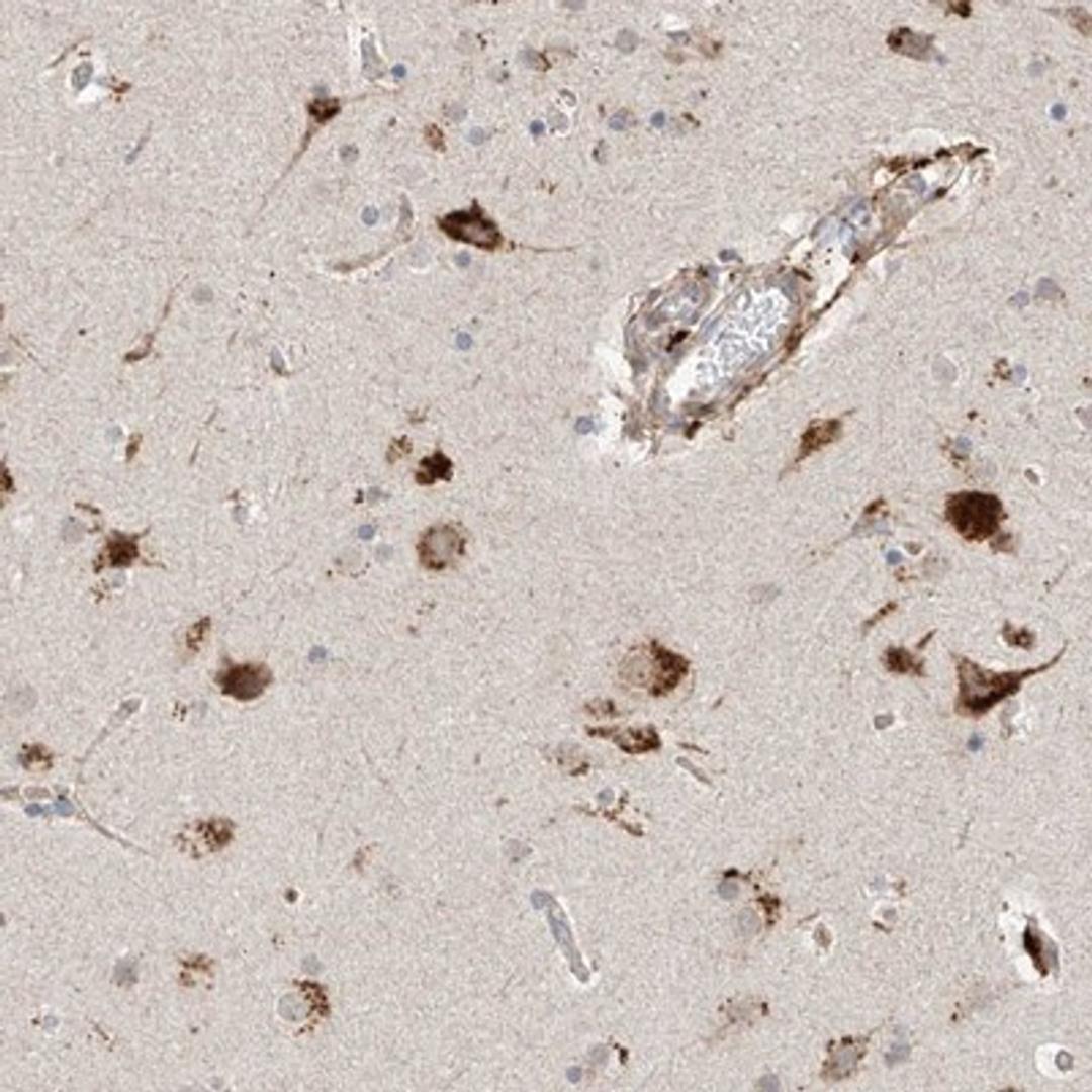 Immunohistochemistry-Paraffin: KIAA0247 Antibody [NBP1-85931] - Staining of human cerebral cortex shows strong cytoplasmic positivity in neuronal cells.