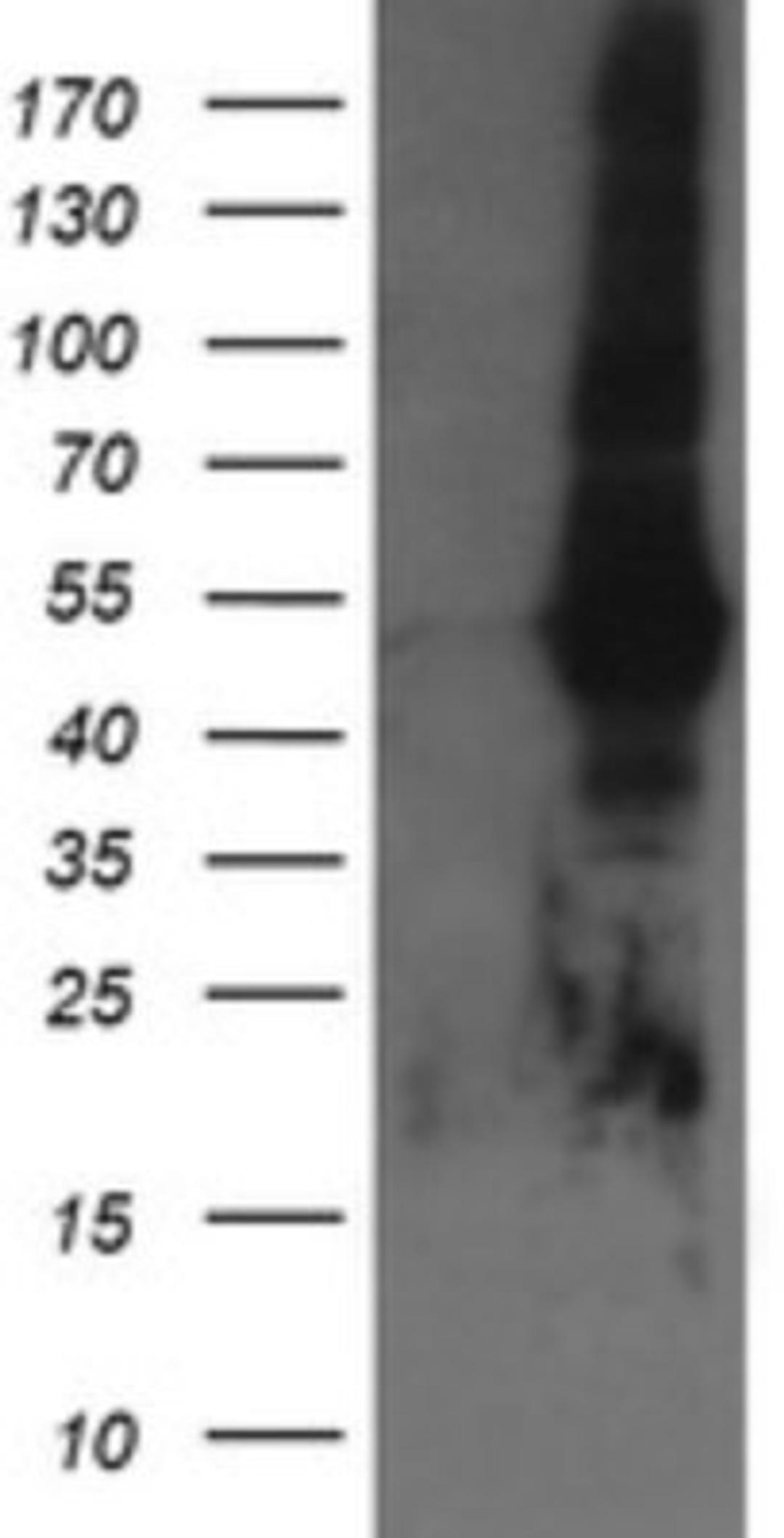 Western Blot: Tapasin Related Protein Antibody (4H5) [NBP2-46066] - Analysis of HEK293T cells were transfected with the pCMV6-ENTRY control (Left lane) or pCMV6-ENTRY Tapasin Related Protein.